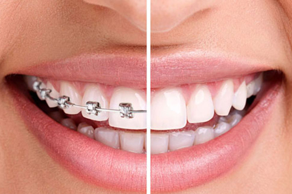 https://thedentists.in.net/wp-content/uploads/2024/12/4-dental-health-problems-that-can-be-fixed-by-orthodontic-treatment-L-1.jpg