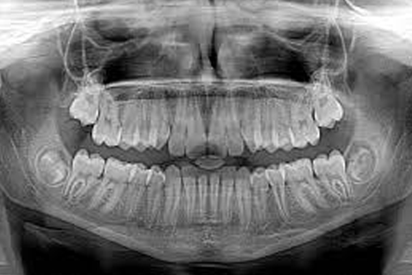 https://thedentists.in.net/wp-content/uploads/2024/12/Dental-X-Ray.jpg